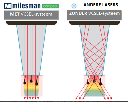 Laserontharing - Heren - Gelaat